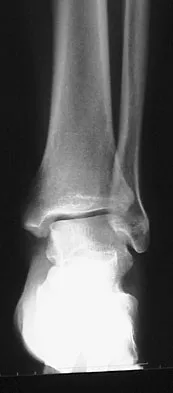 General Orthopedics 2026 Practice Questions: Set 11 (Solved) - Figure 14