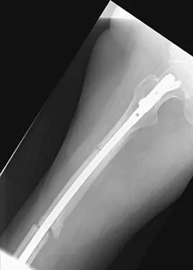 General Orthopedics 2026 Practice Questions: Set 11 (Solved) - Figure 21