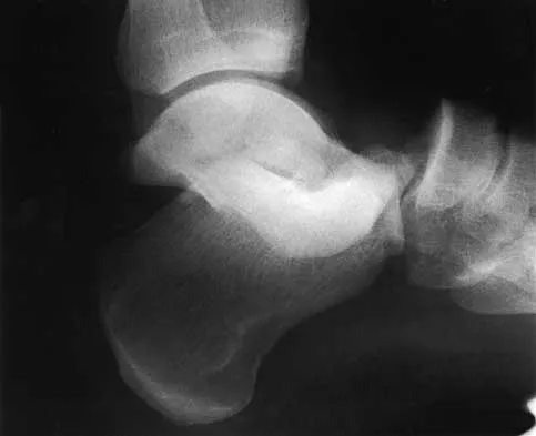 General Orthopedics 2026 Practice Questions: Set 11 (Solved) - Figure 23