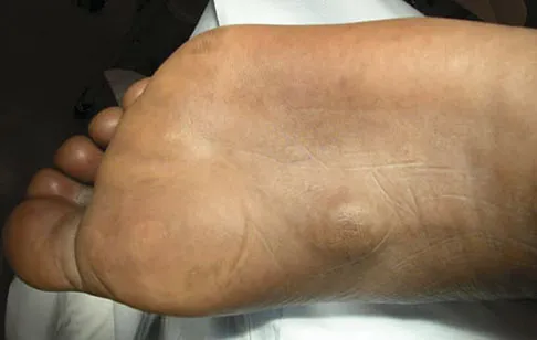 General Orthopedics 2026 Practice Questions: Set 11 (Solved) - Figure 27