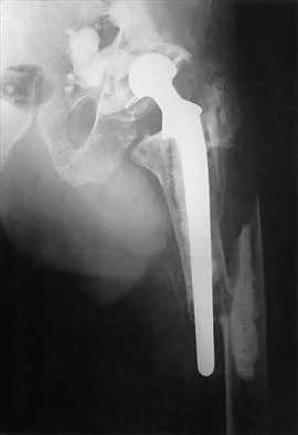 General Orthopedics 2026 Practice Questions: Set 11 (Solved) - Figure 29