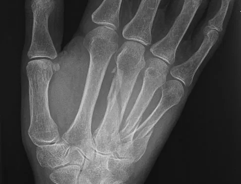 General Orthopedics 2026 Practice Questions: Set 11 (Solved) - Figure 3