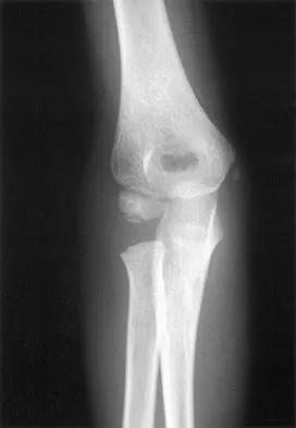 General Orthopedics 2026 Practice Questions: Set 11 (Solved) - Figure 30