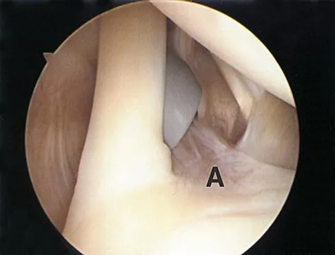 General Orthopedics 2026 Practice Questions: Set 11 (Solved) - Figure 32