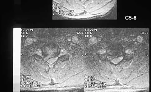 General Orthopedics 2026 Practice Questions: Set 11 (Solved) - Figure 34