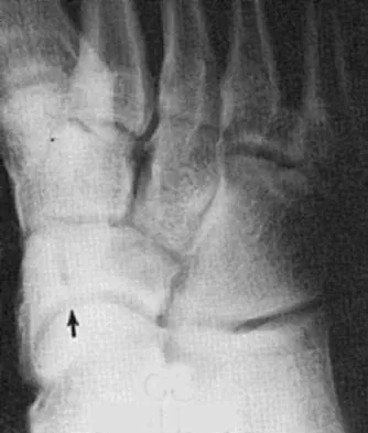 General Orthopedics 2026 Practice Questions: Set 11 (Solved) - Figure 35