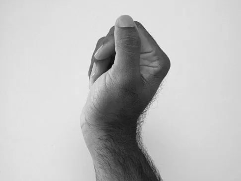 General Orthopedics 2026 Practice Questions: Set 11 (Solved) - Figure 38