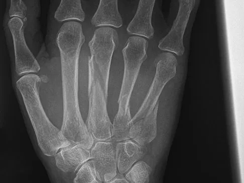 General Orthopedics 2026 Practice Questions: Set 11 (Solved) - Figure 4