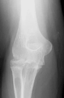 General Orthopedics 2026 Practice Questions: Set 11 (Solved) - Figure 40