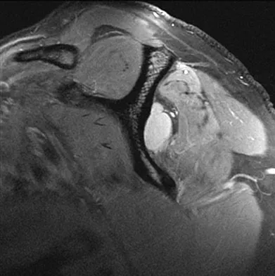 General Orthopedics 2026 Practice Questions: Set 11 (Solved) - Figure 43