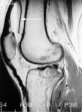 General Orthopedics 2026 Practice Questions: Set 11 (Solved) - Figure 44
