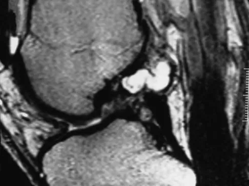 General Orthopedics 2026 Practice Questions: Set 11 (Solved) - Figure 49