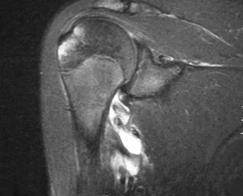 General Orthopedics 2026 Practice Questions: Set 11 (Solved) - Figure 50