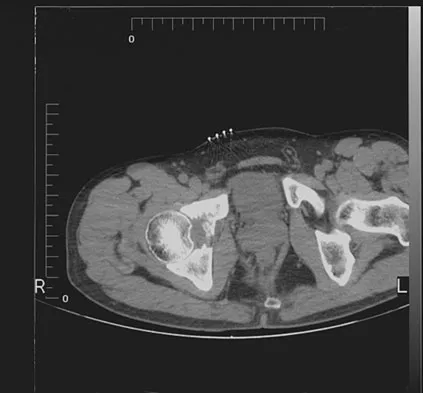General Orthopedics 2026 Practice Questions: Set 11 (Solved) - Figure 51