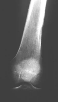 General Orthopedics 2026 Practice Questions: Set 11 (Solved) - Figure 60
