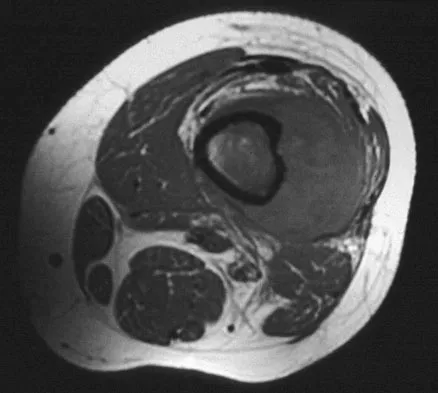 General Orthopedics 2026 Practice Questions: Set 11 (Solved) - Figure 61