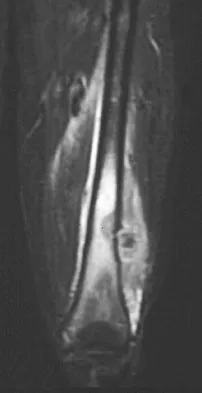 General Orthopedics 2026 Practice Questions: Set 11 (Solved) - Figure 62