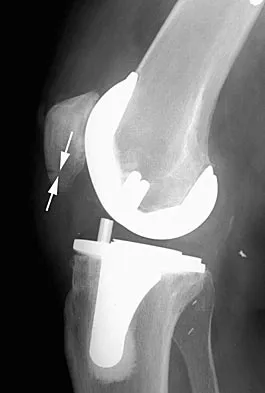 General Orthopedics 2026 Practice Questions: Set 11 (Solved) - Figure 66