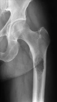 General Orthopedics 2026 Practice Questions: Set 11 (Solved) - Figure 67