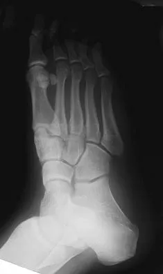 General Orthopedics 2026 Practice Questions: Set 11 (Solved) - Figure 7