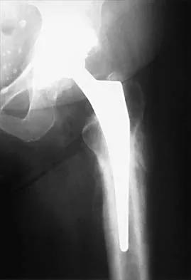 General Orthopedics 2026 Practice Questions: Set 11 (Solved) - Figure 71