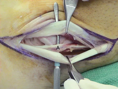 General Orthopedics 2026 Practice Questions: Set 11 (Solved) - Figure 79