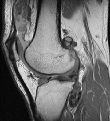 General Orthopedics Board Review 2026: High-Yield MCQs (Set 12) - Figure 11