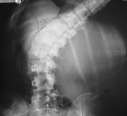 General Orthopedics Board Review 2026: High-Yield MCQs (Set 12) - Figure 23