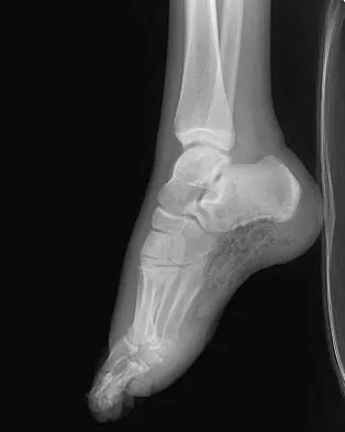 General Orthopedics Board Review 2026: High-Yield MCQs (Set 12) - Figure 25