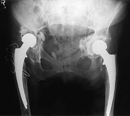 General Orthopedics Board Review 2026: High-Yield MCQs (Set 12) - Figure 26