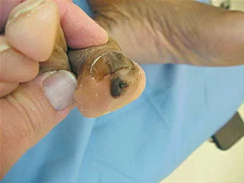 General Orthopedics Board Review 2026: High-Yield MCQs (Set 12) - Figure 27