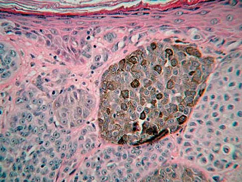 General Orthopedics Board Review 2026: High-Yield MCQs (Set 12) - Figure 28