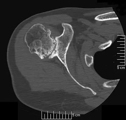 General Orthopedics Board Review 2026: High-Yield MCQs (Set 12) - Figure 3