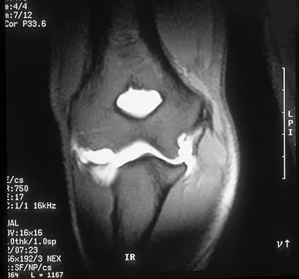 General Orthopedics Board Review 2026: High-Yield MCQs (Set 12) - Figure 30