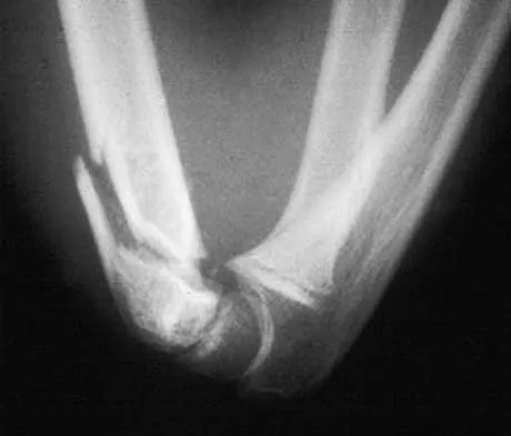 General Orthopedics Board Review 2026: High-Yield MCQs (Set 12) - Figure 31