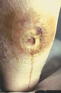 General Orthopedics Board Review 2026: High-Yield MCQs (Set 12) - Figure 33