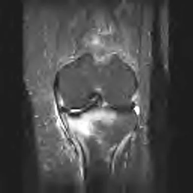 General Orthopedics Board Review 2026: High-Yield MCQs (Set 12) - Figure 42