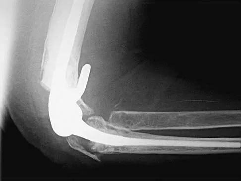 General Orthopedics Board Review 2026: High-Yield MCQs (Set 12) - Figure 45