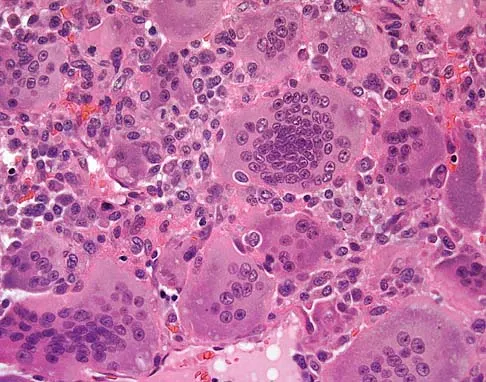 General Orthopedics Board Review 2026: High-Yield MCQs (Set 12) - Figure 50