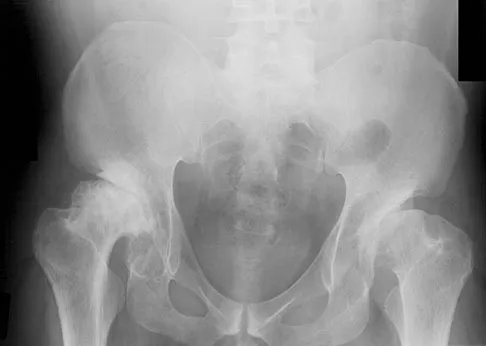 General Orthopedics Board Review 2026: High-Yield MCQs (Set 12) - Figure 52