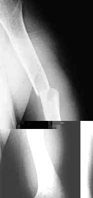 General Orthopedics Board Review 2026: High-Yield MCQs (Set 12) - Figure 59