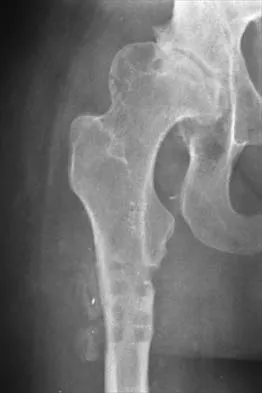 General Orthopedics Board Review 2026: High-Yield MCQs (Set 12) - Figure 6