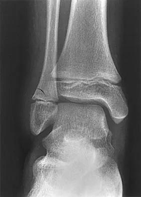 General Orthopedics Board Review 2026: High-Yield MCQs (Set 12) - Figure 61