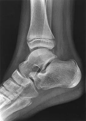 General Orthopedics Board Review 2026: High-Yield MCQs (Set 12) - Figure 62