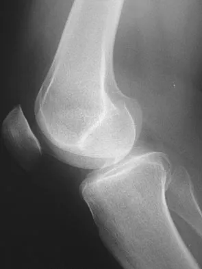 General Orthopedics Board Review 2026: High-Yield MCQs (Set 12) - Figure 65