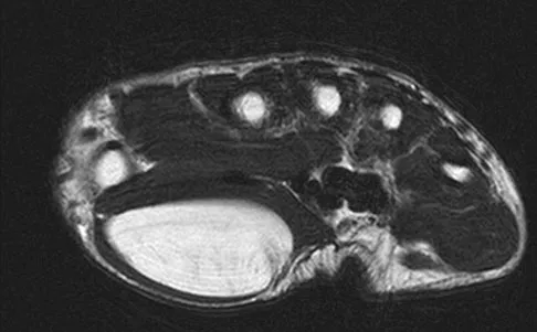 General Orthopedics Board Review 2026: High-Yield MCQs (Set 12) - Figure 67