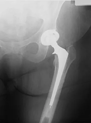 General Orthopedics Board Review 2026: High-Yield MCQs (Set 12) - Figure 70