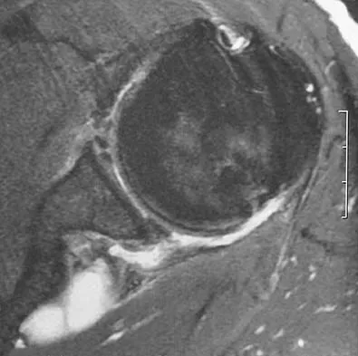 General Orthopedics Board Review 2026: High-Yield MCQs (Set 12) - Figure 71