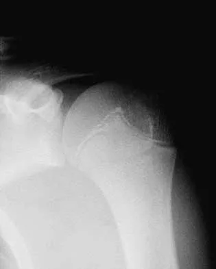 General Orthopedics Board Review 2026: High-Yield MCQs (Set 12) - Figure 73