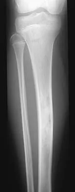 General Orthopedics Board Review 2026: High-Yield MCQs (Set 12) - Figure 78